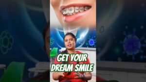Get Your Dream Smile in Just 1 Week