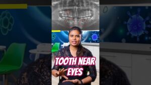 When a Tooth Grows in the Wrong Place!